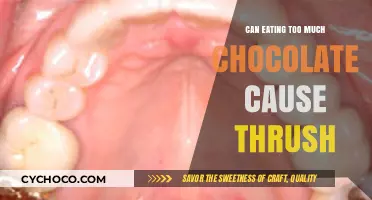 Chocolate and Thrush: Unraveling the Sweet Connection to Oral Health