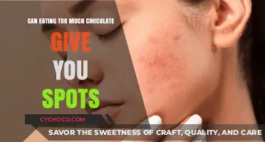 Does Chocolate Cause Acne? Debunking the Sweet Spot Myth