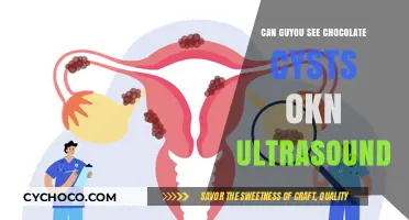 Decoding Ultrasound Images: Can You Spot Chocolate Cysts?
