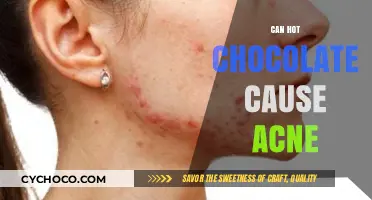 Sipping on Comfort: Does Hot Chocolate Trigger Acne?