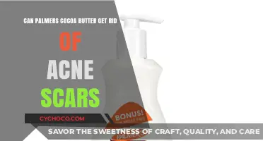 Discover the Truth: Can Palmer's Cocoa Butter Fade Acne Scars?