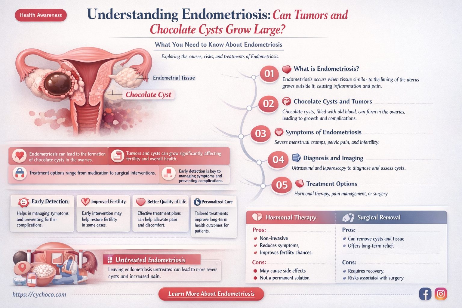 can endometriosis tumors or chocolate cysts grow big