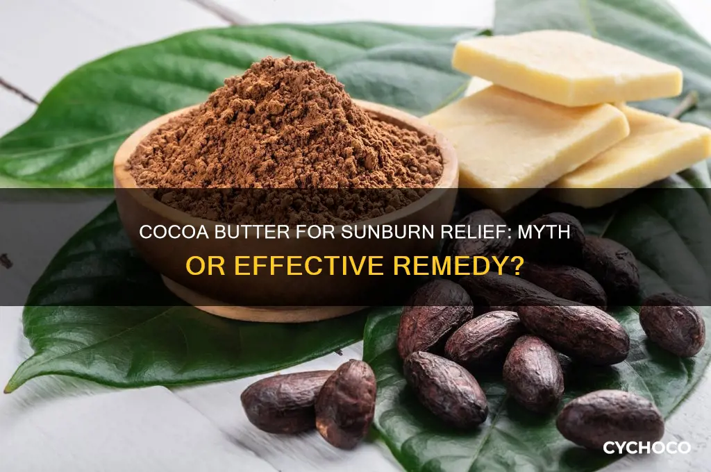does cocoa butter help sunburn
