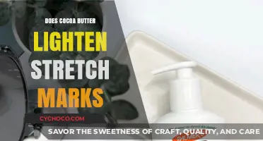The Truth About Cocoa Butter and Stretch Marks: Does It Really Work?
