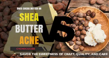 Cocoa Butter vs Shea Butter: Which is Better for Acne-Prone Skin?