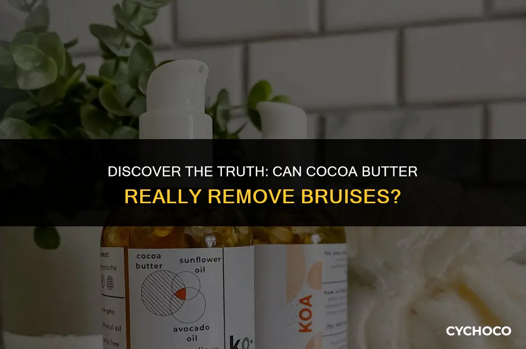 does cocoa butter remove bruises