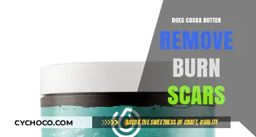 Healing Benefits of Cocoa Butter: Does It Remove Burn Scars?