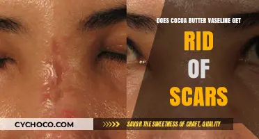 The Ultimate Guide to Scar Removal: Cocoa Butter Vaseline Edition