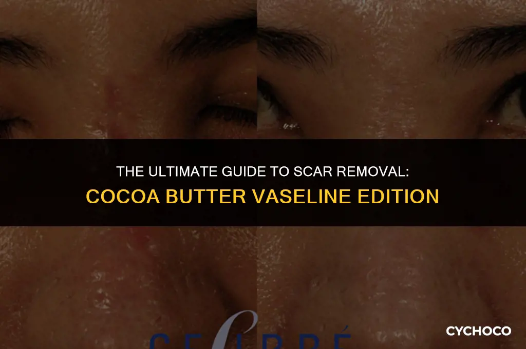 does cocoa butter vaseline get rid of scars