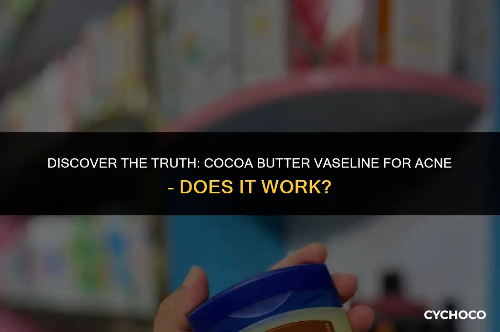 does cocoa butter vaseline help with acne