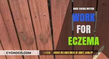 Soothing Eczema: The Natural Benefits of Cocoa Butter