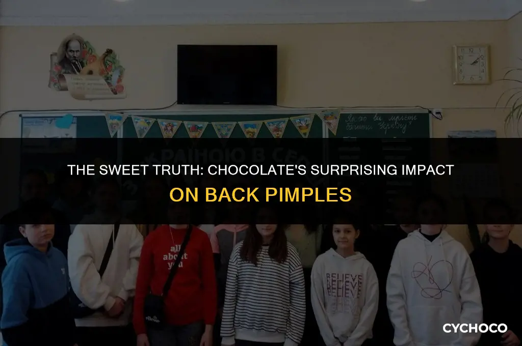 does eating alot of chocolate cause back pimples