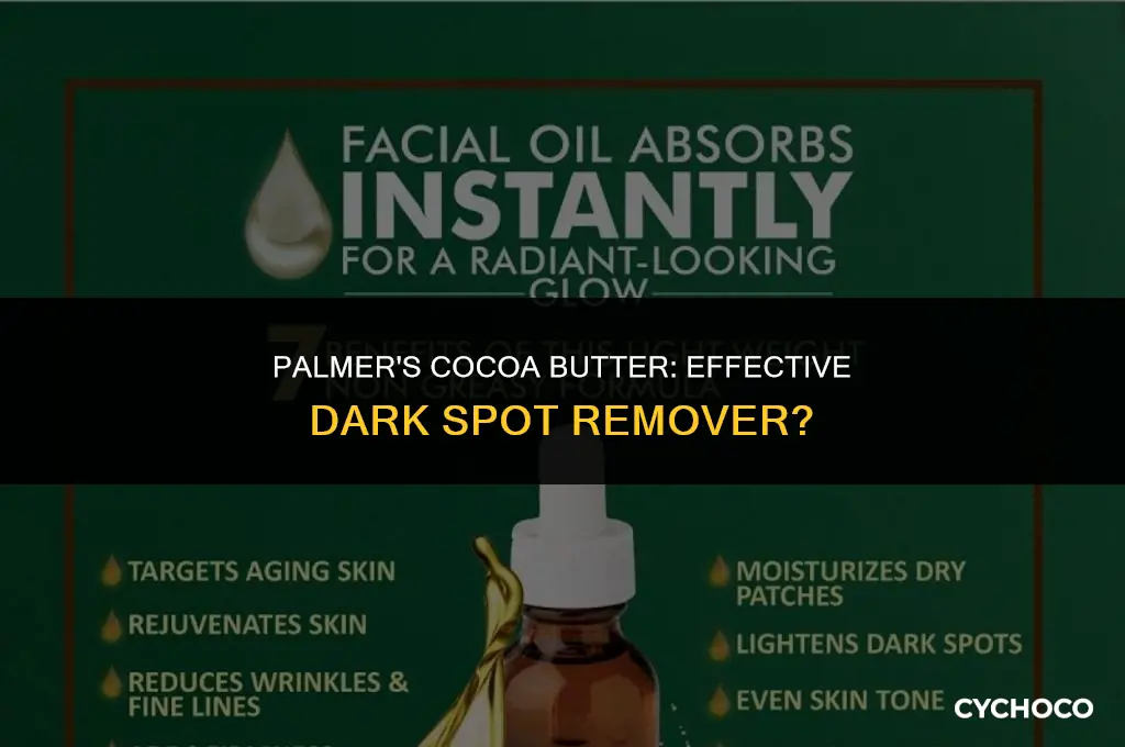 does palmer