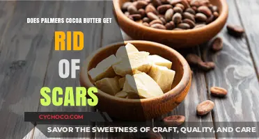Palmer's Cocoa Butter: The Ultimate Scar Solution?