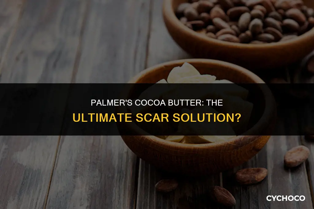does palmers cocoa butter get rid of scars