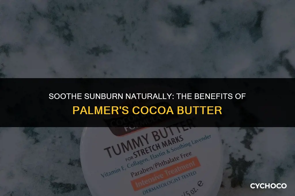 does palmer