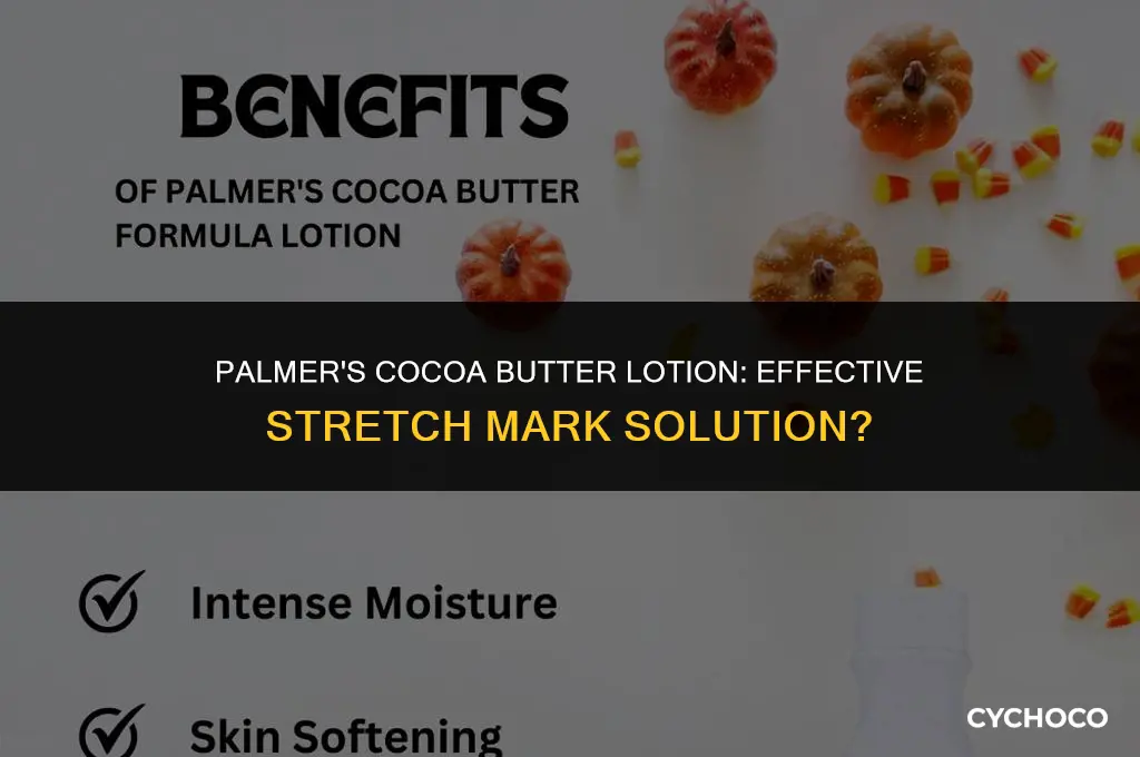 does palmers cocoa butter stretch mark lotion work