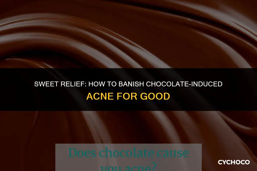 how to get rid of acne caused by chocolate