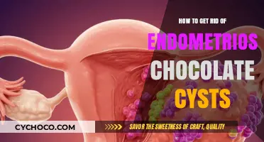 Natural Remedies to Dissolve Endometriosis Chocolate Cysts: A Holistic Guide