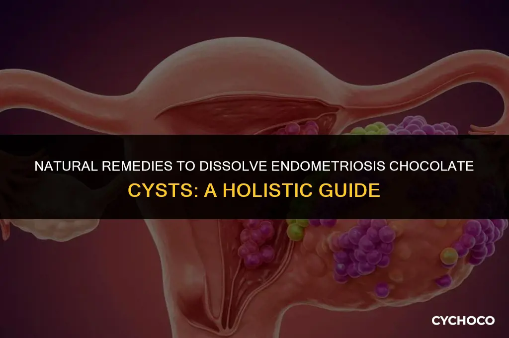 how to get rid of endometriosis chocolate cysts