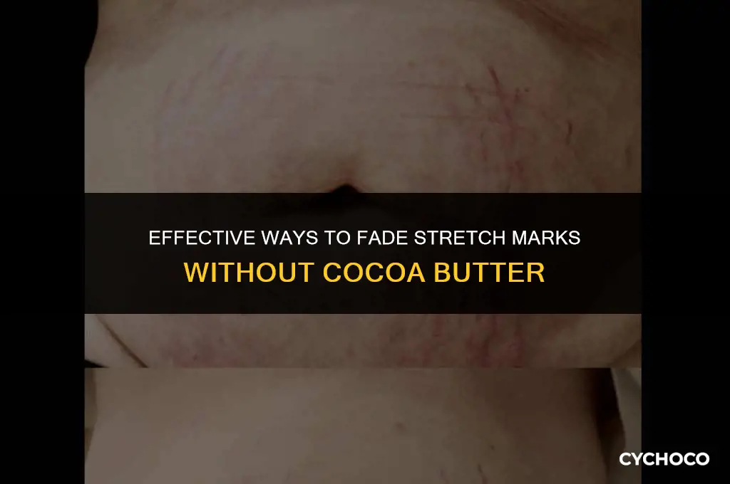 how to get rid of stretch marks without cocoa butter