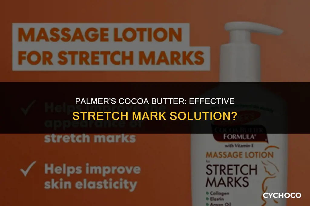how well does palmers cocoa butter work on stretch marks