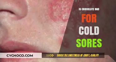 The Sweet Truth: Chocolate's Surprising Impact on Cold Sores