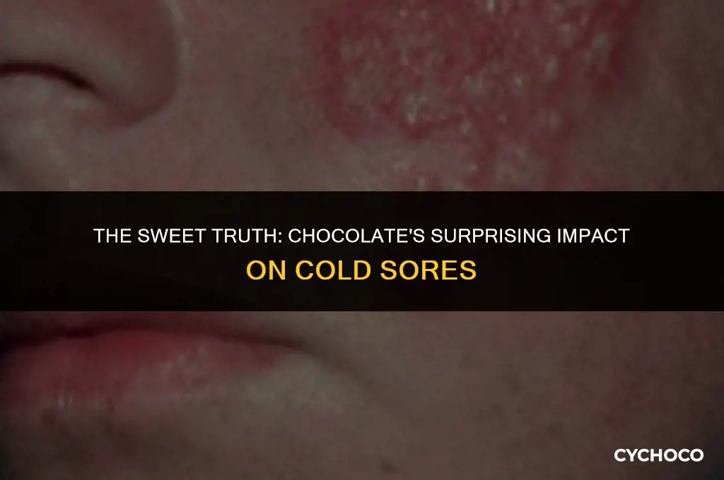 is chocolate bad for cold sores