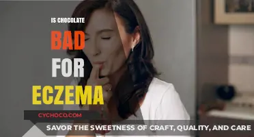 Decoding the Chocolate-Eczema Connection: Facts vs. Myths