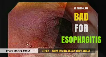 Decoding the Chocolate Conundrum: Is It Bad for Esophagitis?