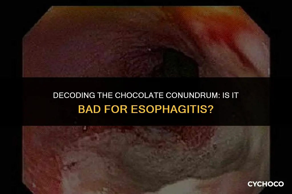 is chocolate bad for esophagitis