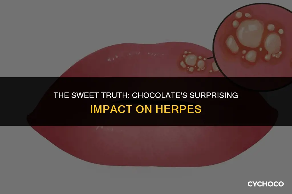 is chocolate bad for herpes