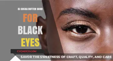Discover the Truth: Cocoa Butter's Role in Healing Black Eyes