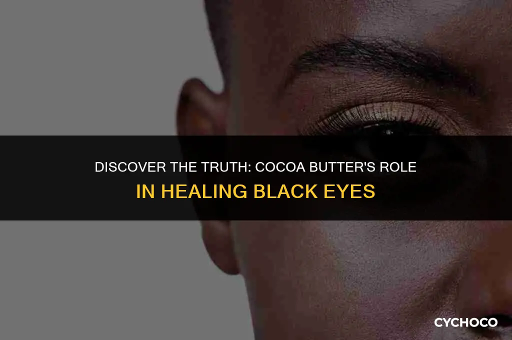 is cocoa butter good for black eyes