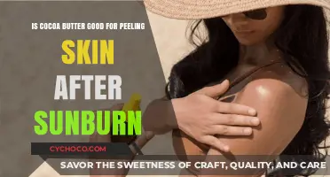 Soothe and Heal: Cocoa Butter's Benefits for Sunburn Peeling Skin