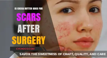 Healing Benefits of Cocoa Butter for Post-Surgical Scars