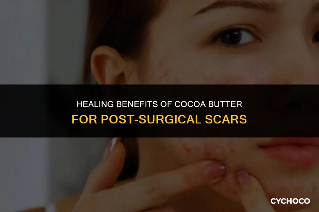is cocoa butter good for scars after surgery