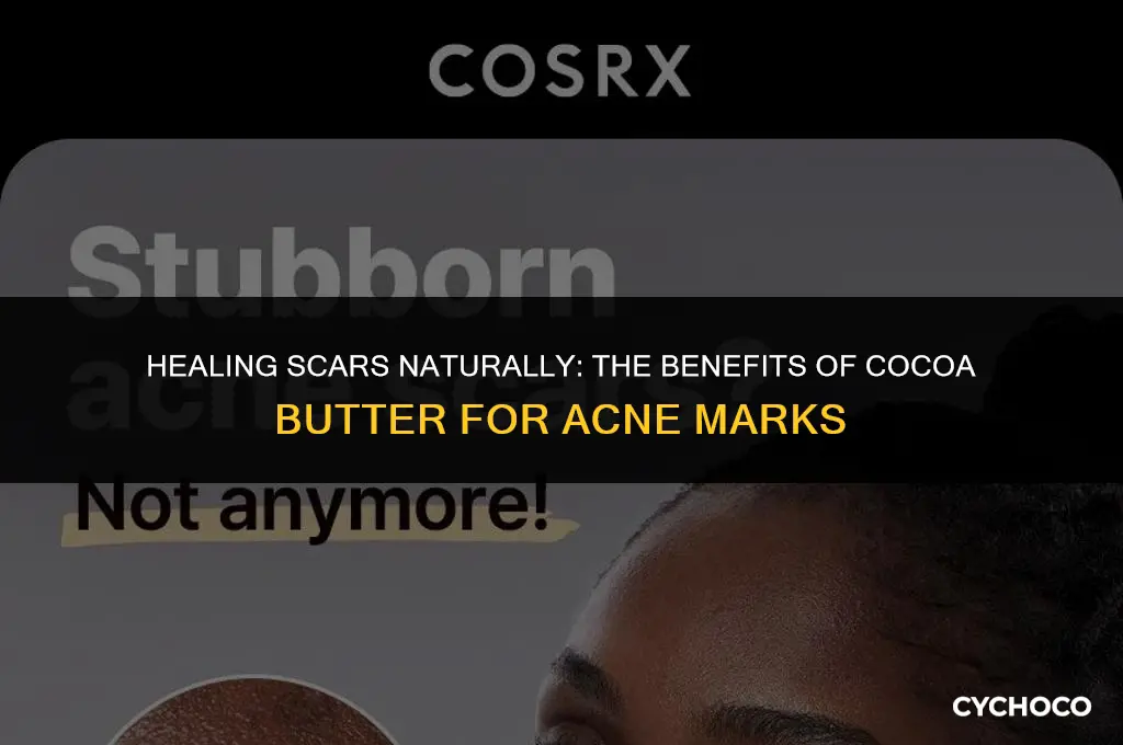 is cocoa butter good for scars from acne