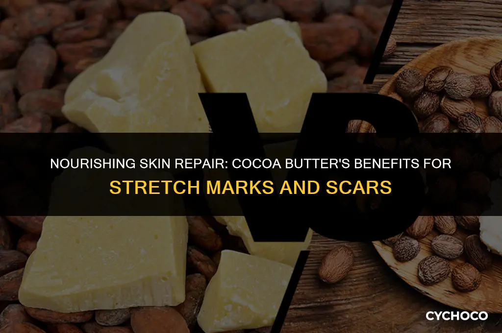 is cocoa butter good for stretch marks and scars