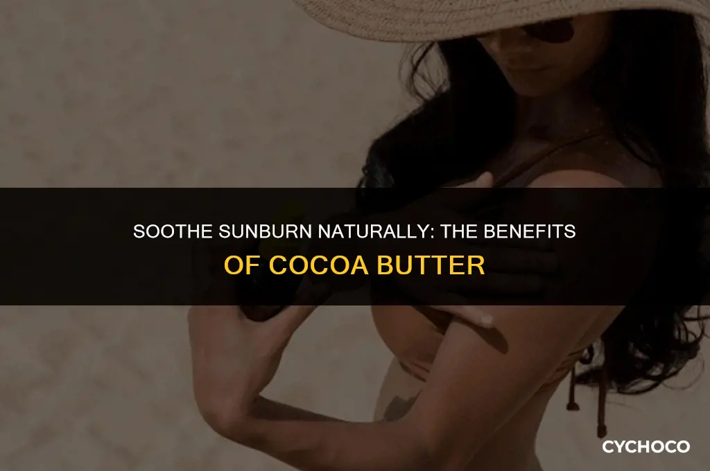 is cocoa butter good for sun burn