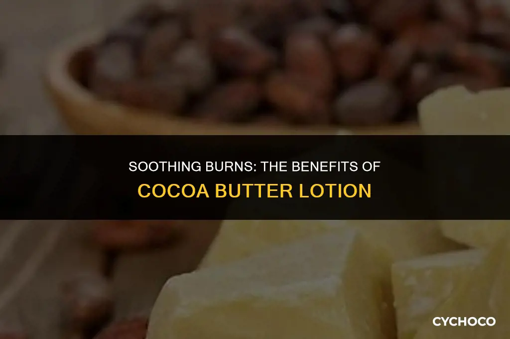 is cocoa butter lotion good for burns