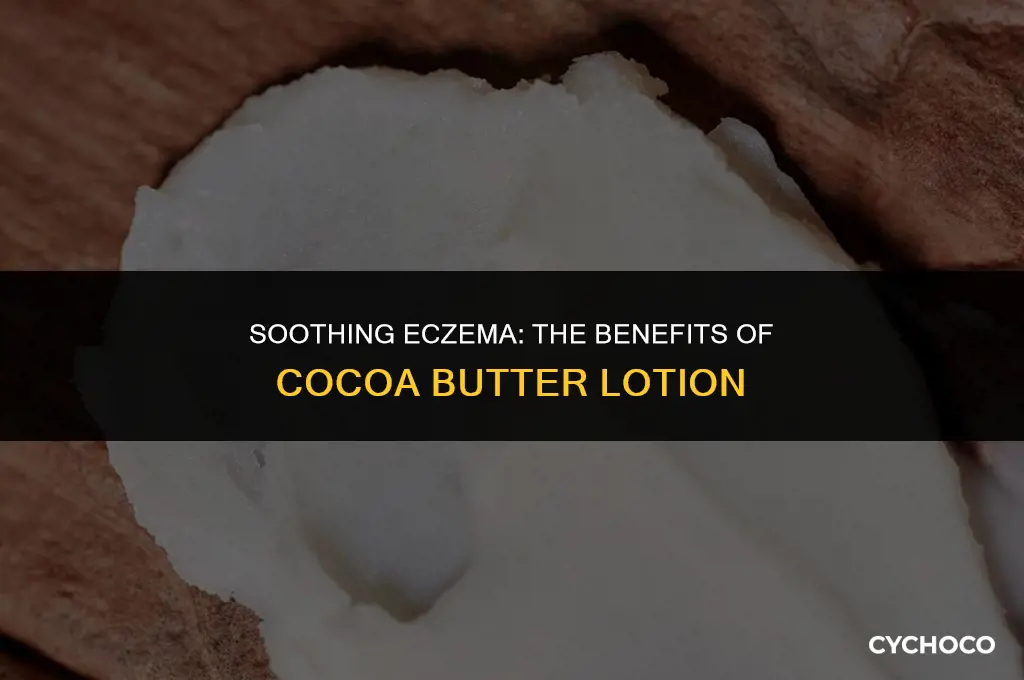 is cocoa butter lotion good for eczema