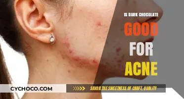 Unveiling the Truth: Dark Chocolate's Surprising Impact on Acne